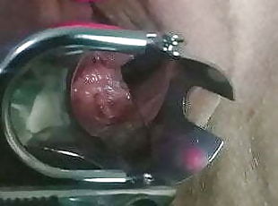 Massive squirt on the camera lens after speculum and double penetra...