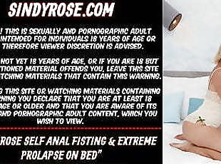 Sindy Rose self anal fisting & extreme prolapse on bed