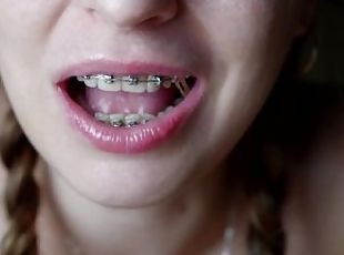 Braces elastics challange! She tried to add elastics as much as she...