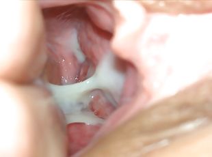Sperm harvesting from fucked pussy with closeup of creampie inside ...