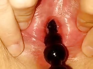 Anal bead peehole