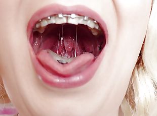 Latex Medical Gloves and Eating Ice Cream (Food Fetish) with Braces...