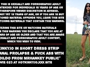 Hotkinkyjo in short dress strip naked, anal prolapse & fuck ass wit...