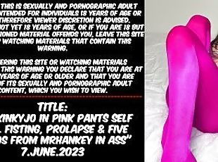 Hotkinkyjo in pink pants self anal fisting, prolapse & FIVE DILDOS ...