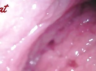 Endoscopic ?vaginal observation????????????