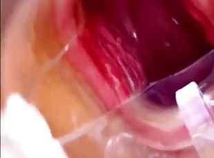 Vagina, cervix Rhythmically hit the orgasm vaginal endoscope with s...